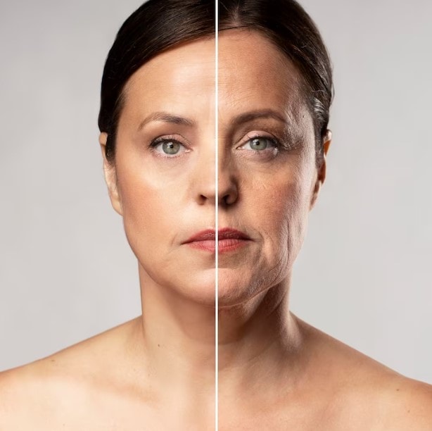 What Causes Sagging Skin & How Do You Treat It