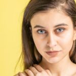 dark circles under eyes