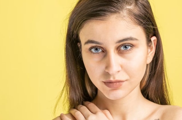 dark circles under eyes